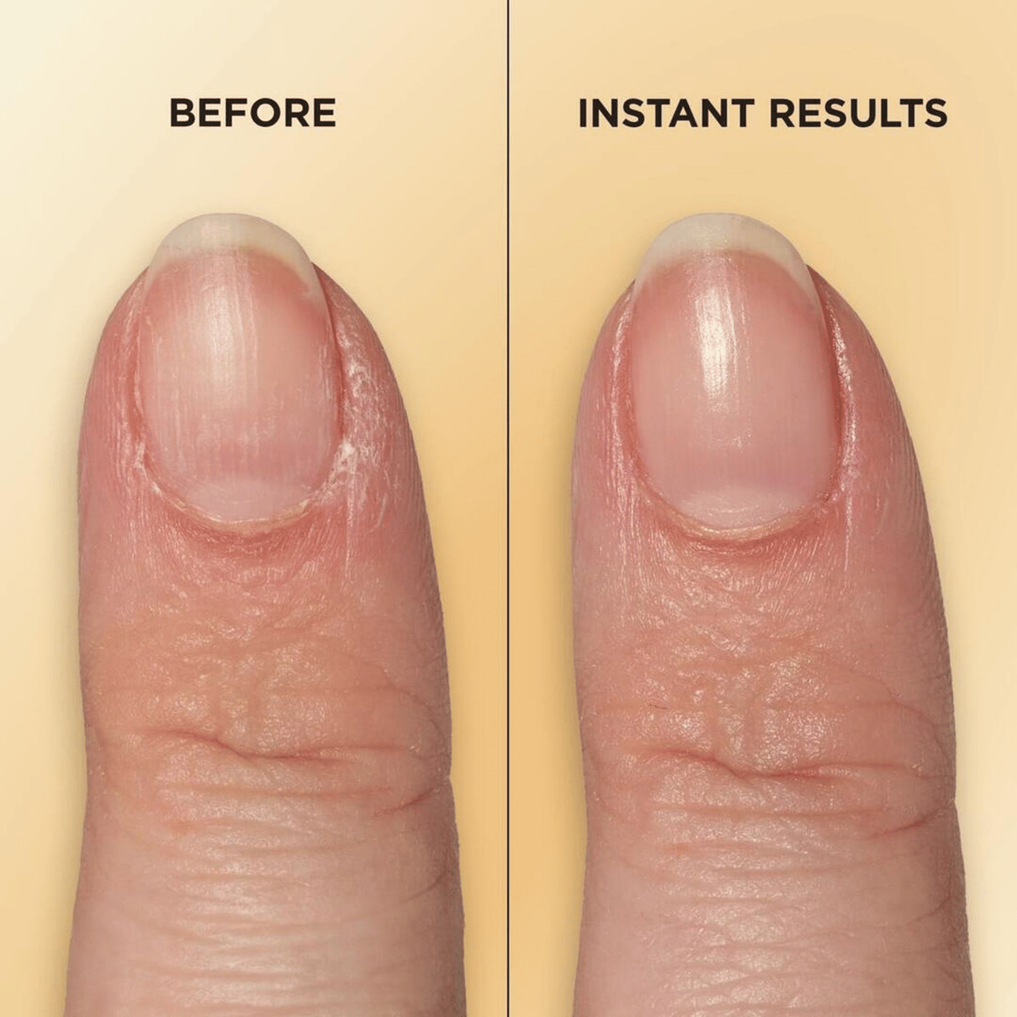 Vitamin E Nail & Cuticle Oil Pen